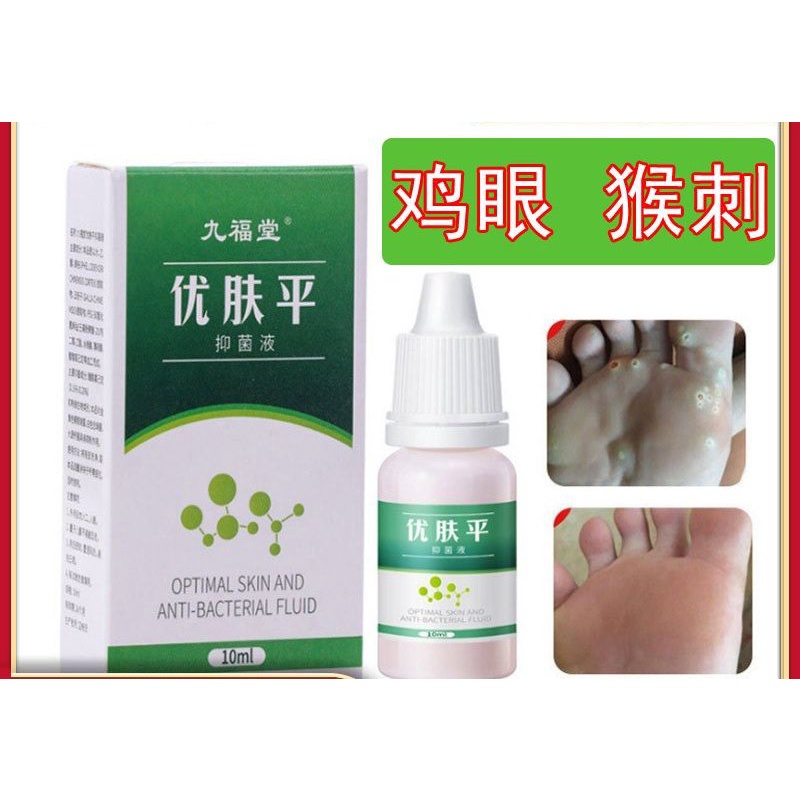 Jiufutang Excellent Skin Flat Corn Oatsal warts Thorn Calluses Flat ...