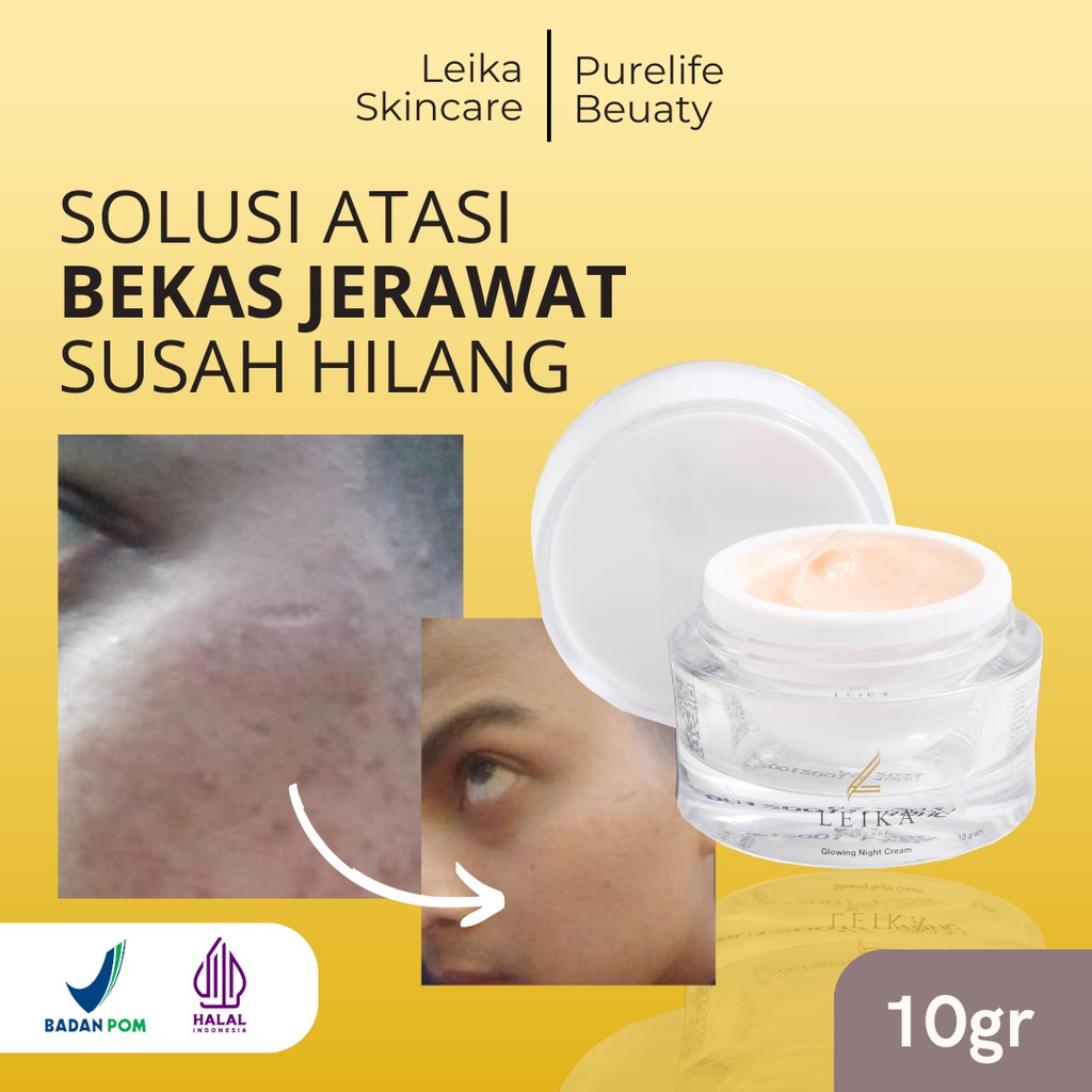 HITAM Black Acne Scar Night Cream Black Acne Scar Remover Acne Scar