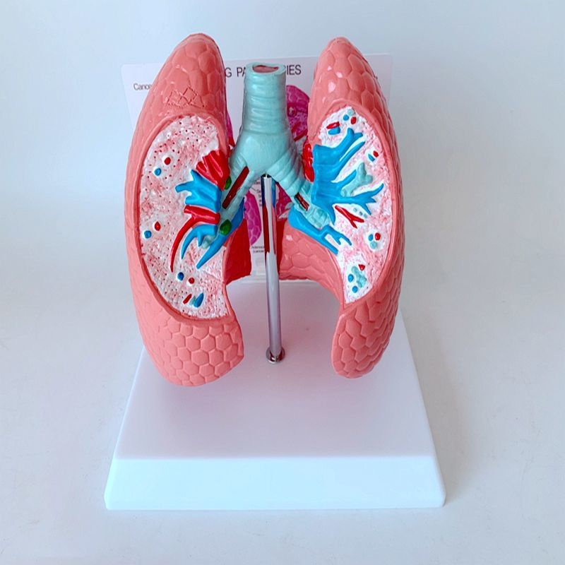 lung-disease-lung-regulation-segment-model-lung-anatomy-bronchial-tree