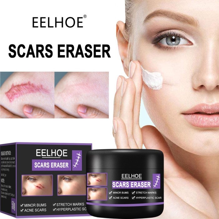 Eelhoe Scar Remover Gel Cream Acne Scar Remover, Acne Shopee Singapore