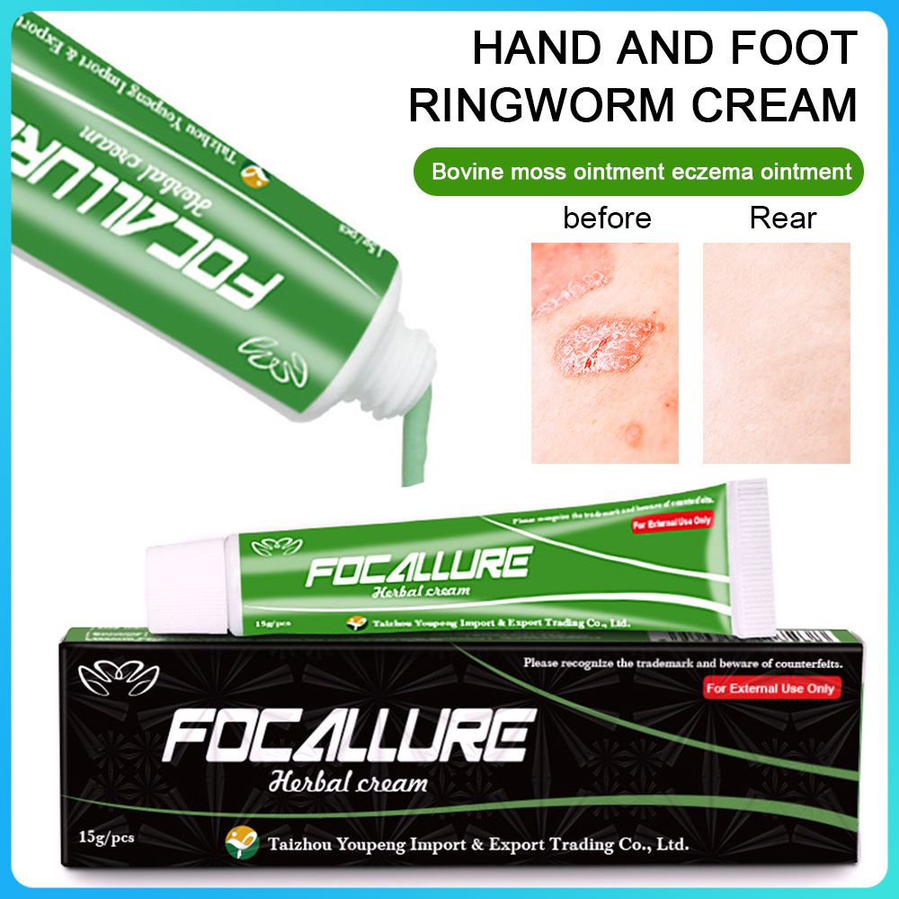 FOCALLURE Body Psoriasis Cream Dermatitis Eczematoid Eczema Ointment ...