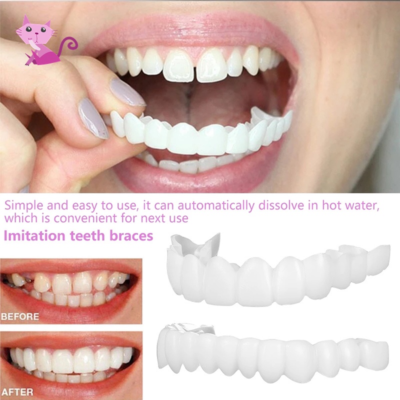 Smart Smile Father's Day Special Temporary Fake Teeth Socket-Perfect ...