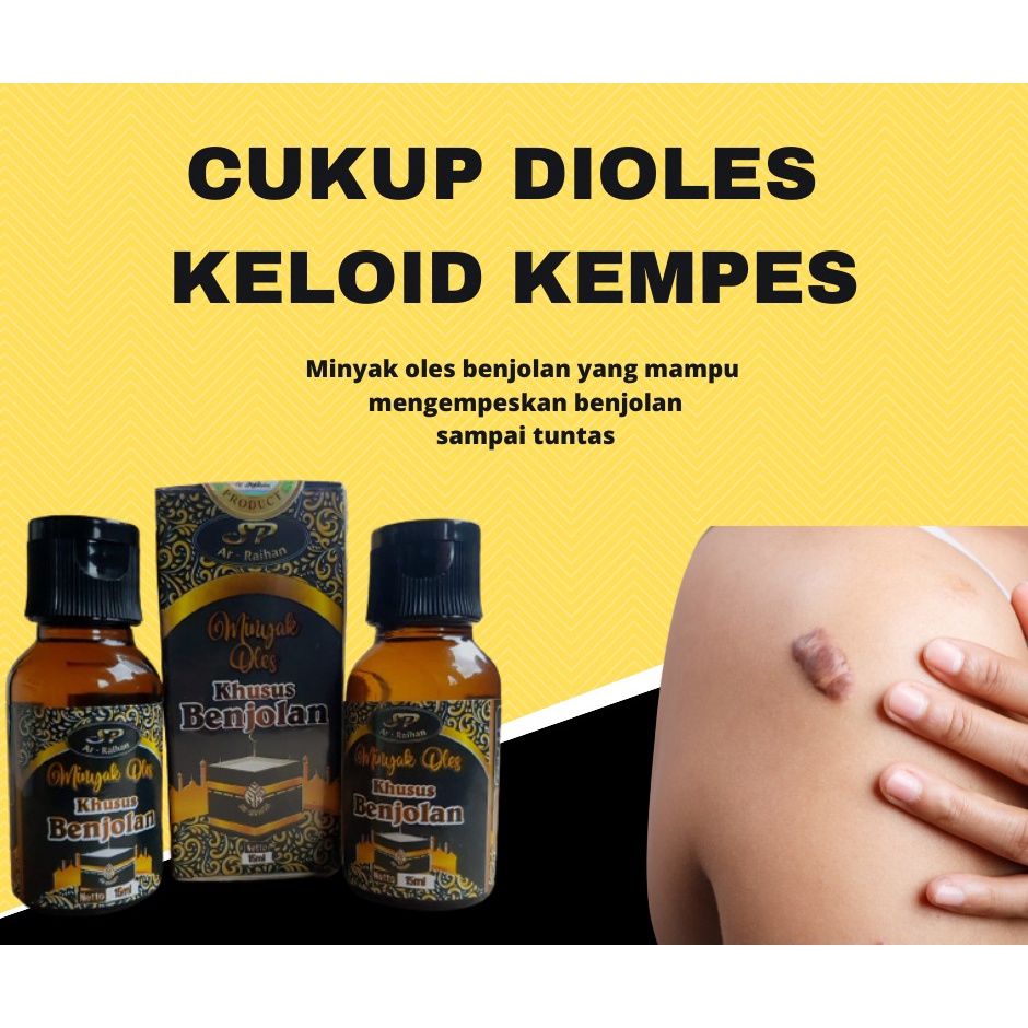 The Best Lumps Oil/The Most Powerful Lumps Medicine/Lumps Medicine In