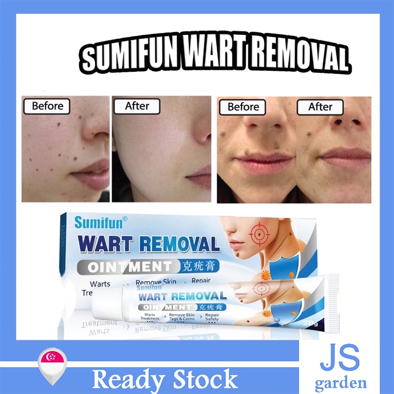 Sumifun Wart Removal Ointment remove skin tags and corns warts Shopee