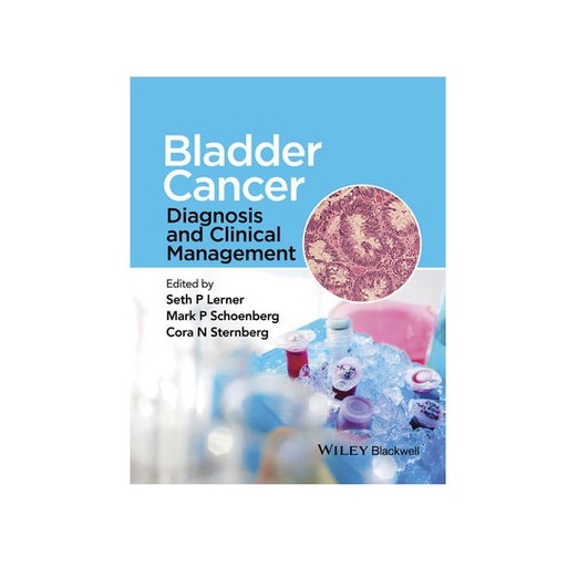 Bladder Cancer - Diagnosis And Clinical Management | Shopee Singapore