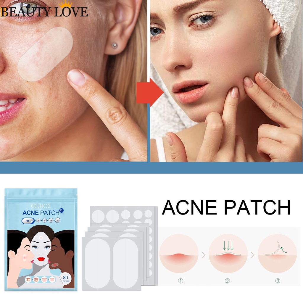 80 Pcs Face Quick Effect Removing Pimple Invisible Patches / Multi ...