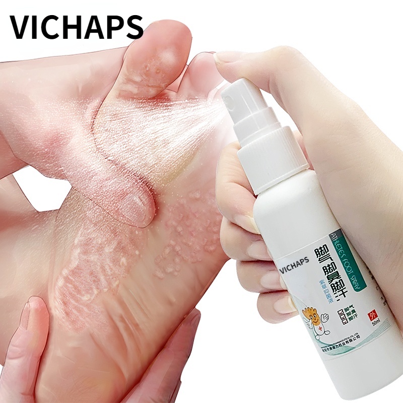 Chinese Herbal Medicine Athlete Foot Antifungal Spray To Remove Foot