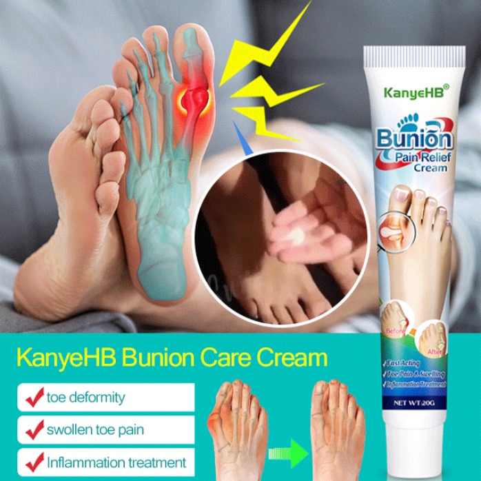 KanyeHB Bunion Pain Relief Cream Shopee Singapore