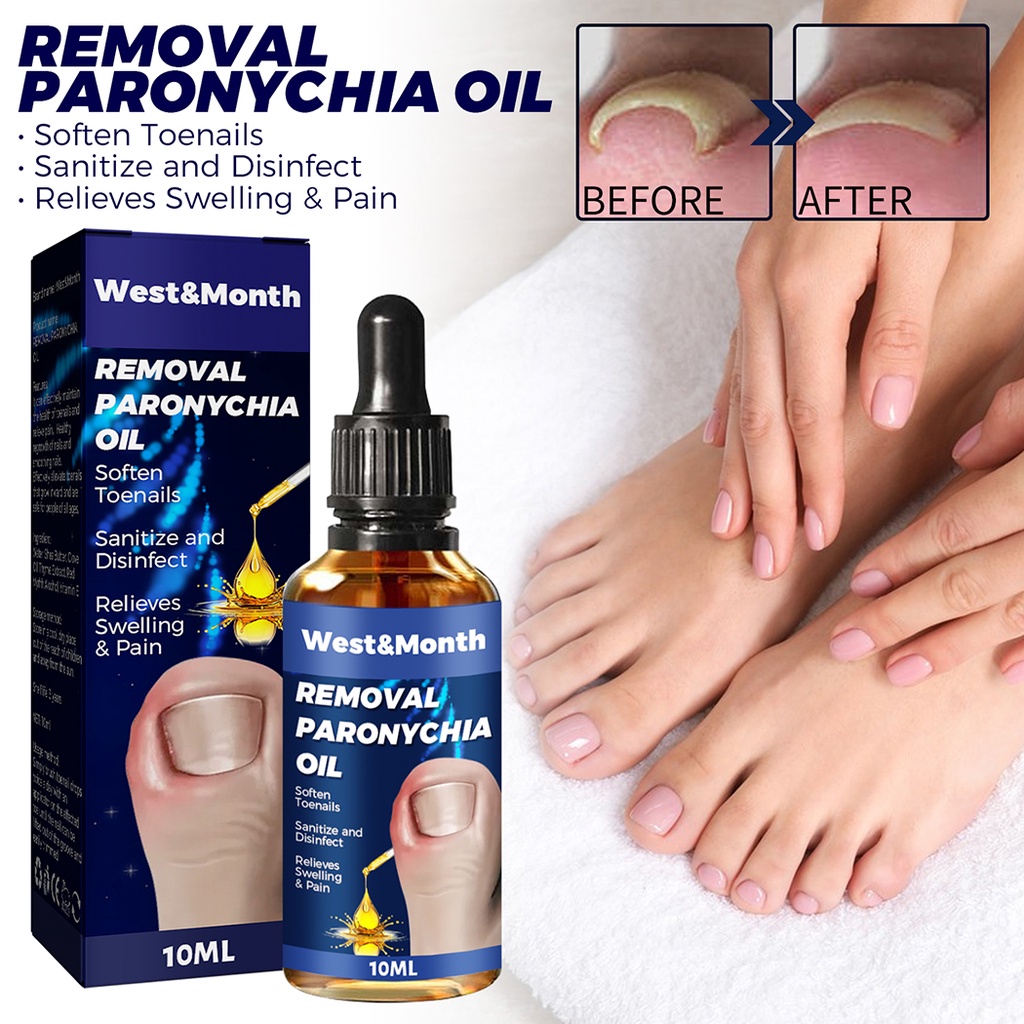 10ml Paronychia Removal Oil Ingrown Toenail Treatment Toe Fingernail 