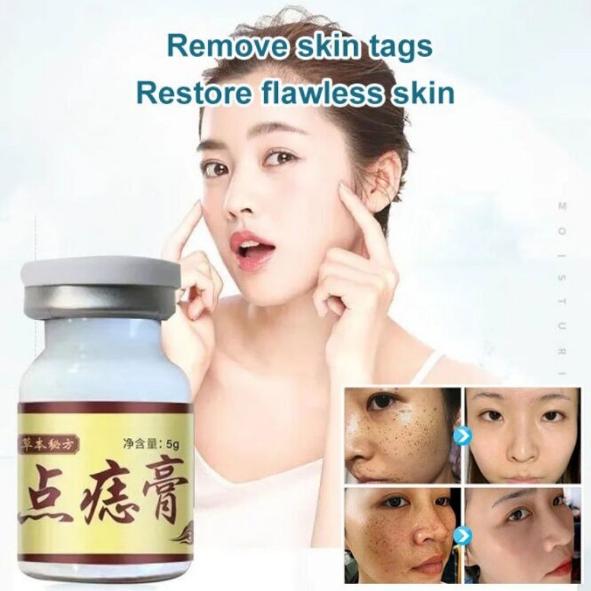 Concentrated Potent Skin Tag Removal Cream Body Warts Cream Spot Mole