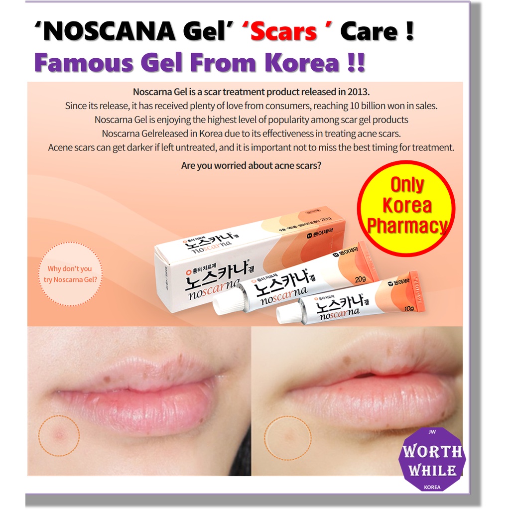 Noscarna gel 20g, Ointment From Korea /Scar Removal /Acne & Pimple