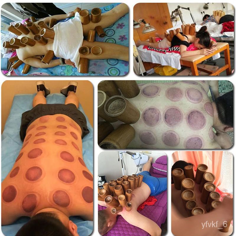 ! Cupping Set Bamboo Pot Cupping Torch for Traditional Chinese Medicine