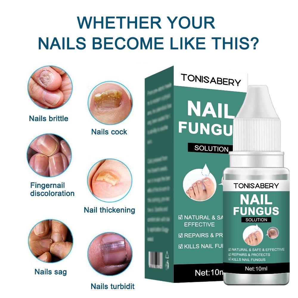 Nail Fungal Treatment Feet Care Essence Anti Infection Paronychia