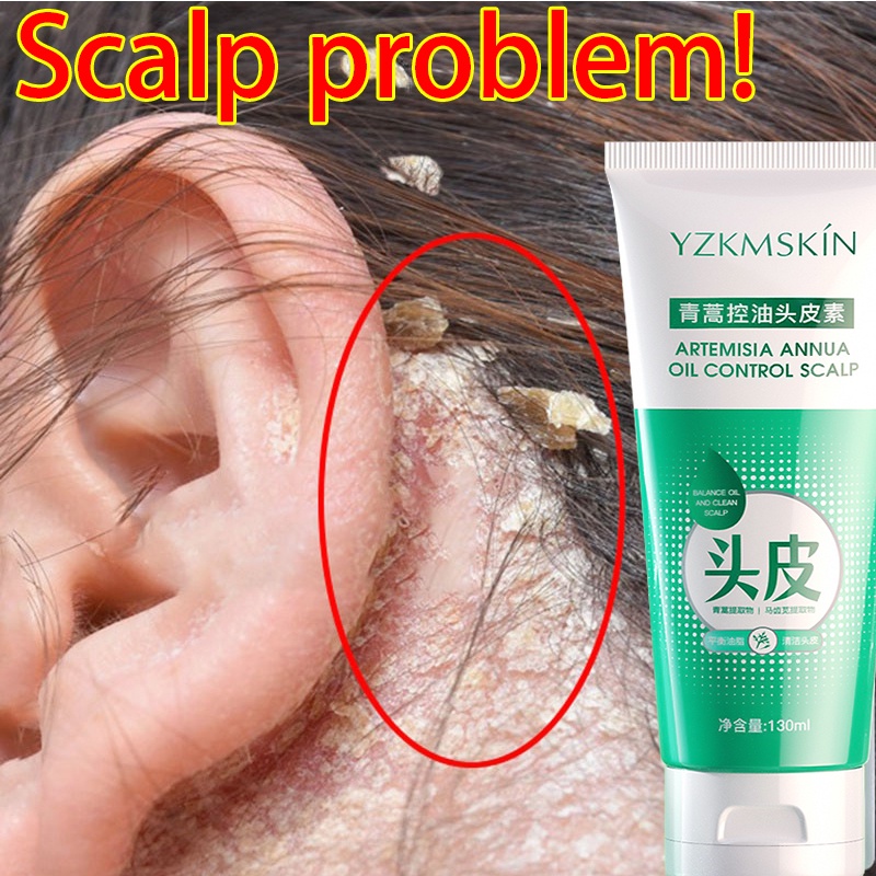 Anti Dandruff Shampoo Oily Scalp Shampoo 130ML Deeply Clean the Scalp