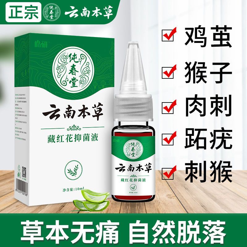 Yunnan Materia Medica chicken eye cream to remove calluses to remove