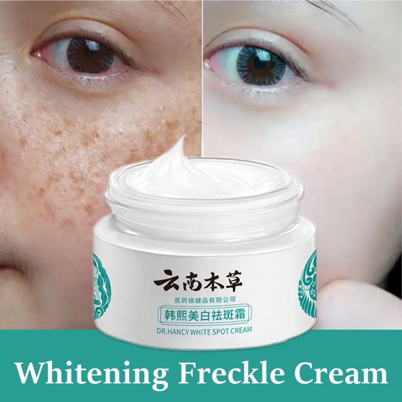 Japanese Melasma Cream Yunnan Herbal Whitening Freckle Cream Japanese