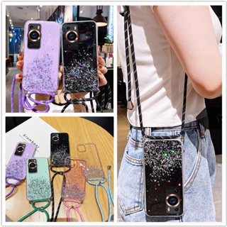 Crossbody lanyard Plating Case For Honor 90 Pro 80 SE 80 GT 60 SE 70 50  Lite 30i 20S Soft TPU Lens protection Shockproof Cover