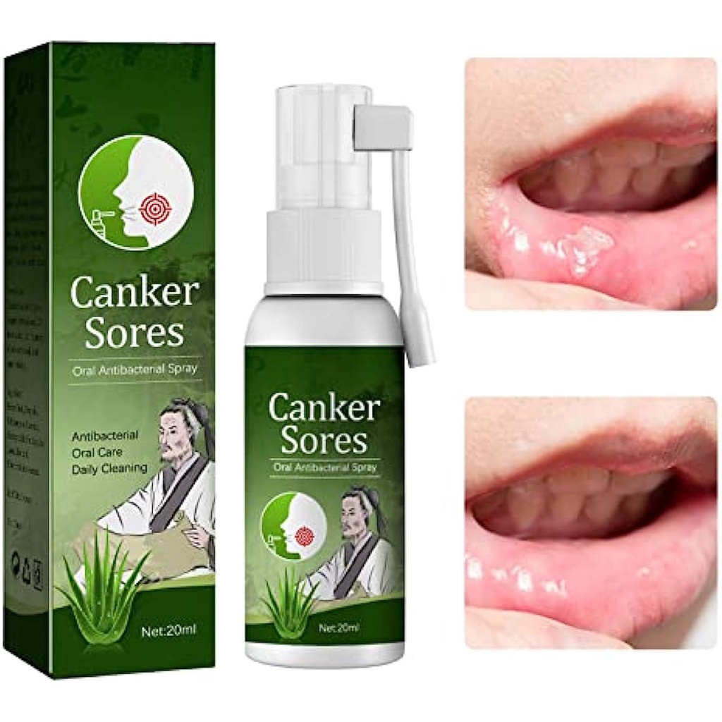 20mL Antiviral Mouth Spray,Mouth Ulcer Treatment,Protect Teeth & Gums