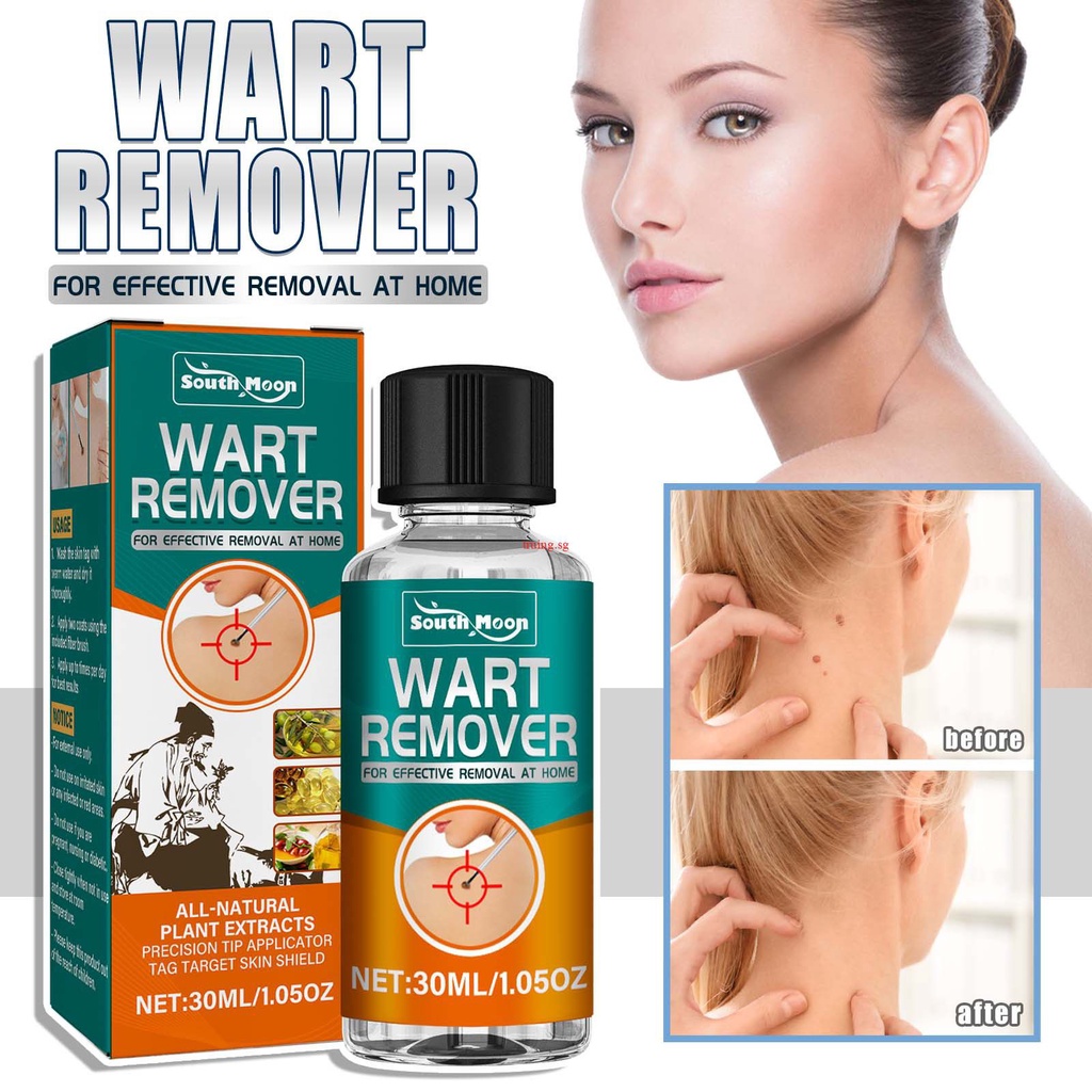 South Moon Skin Tag Remover Painless Mole Skin Dark Spot Wart Makeup