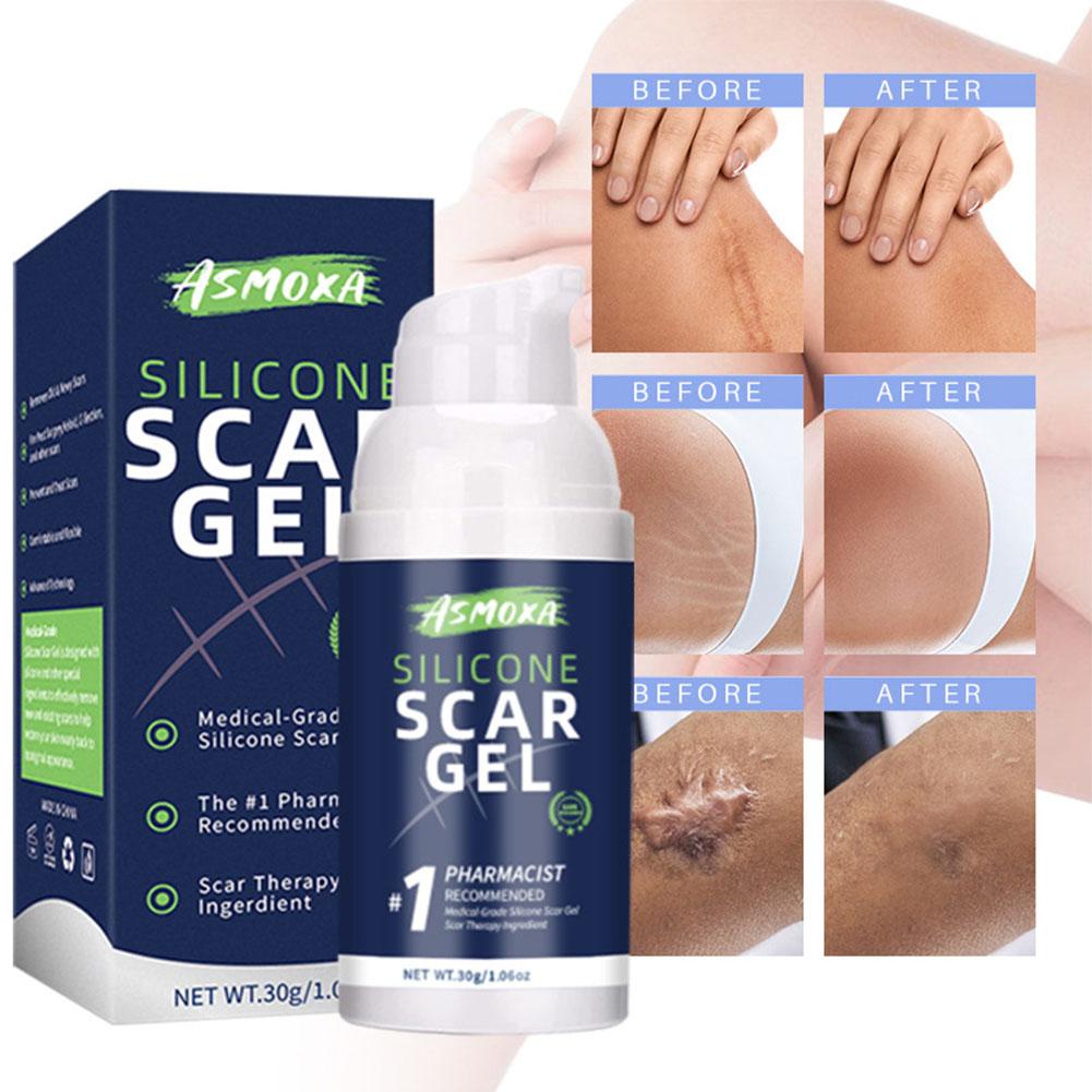 30g Silicone Scar Gel Skin Repair Cream Surgery Scar Gel Removal ...