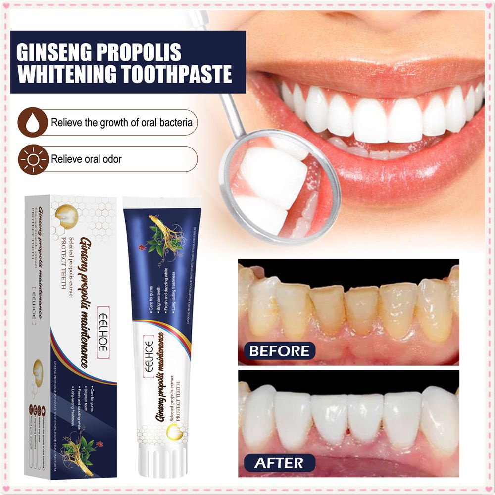 EELHOE Ginseng Propolis Toothpaste Brightening Whitening Deep Cleaning ...