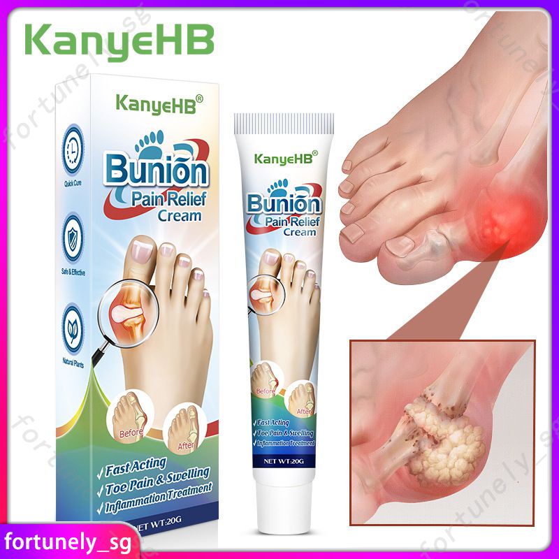 Kanyehb Bunion Cream Skin Topical Ointment Foot Swelling Sore Toe Joint ...