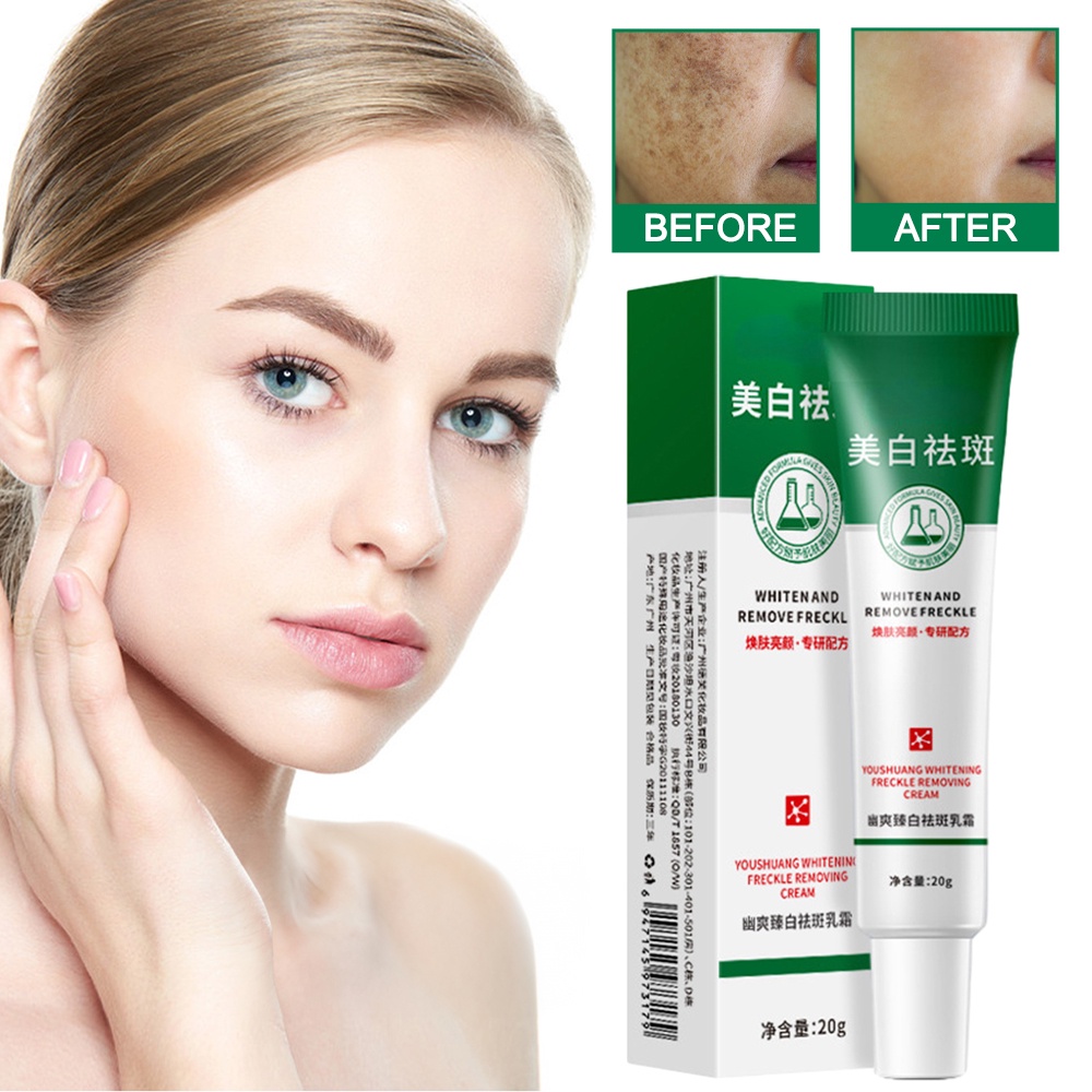 Whitening Freckle Removing Cream Dark Spot Remover for Face and Body ...