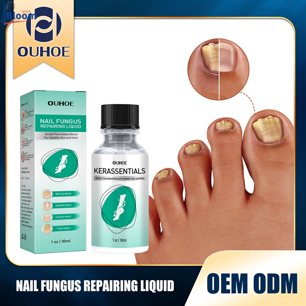 OUHOE Nail Repair Liquid Hand And Foot Thickened Onychomycosis Repair