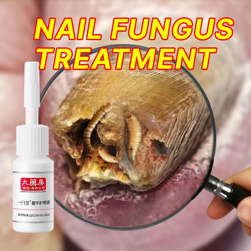 Nail Fungus Treatment Best Nail Repair Stop Fungal Growth Effective Fingernail & Renew Damaged
