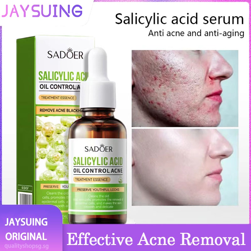 Effective Acne Remove Salicylic Acid Serum Pimple Remover Cream Fades