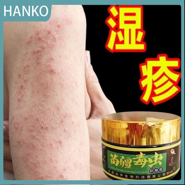 HANKO Eczema, sweat, herpes, desquamation, scrotal eczema, red pimple, dermatitis cream, skin