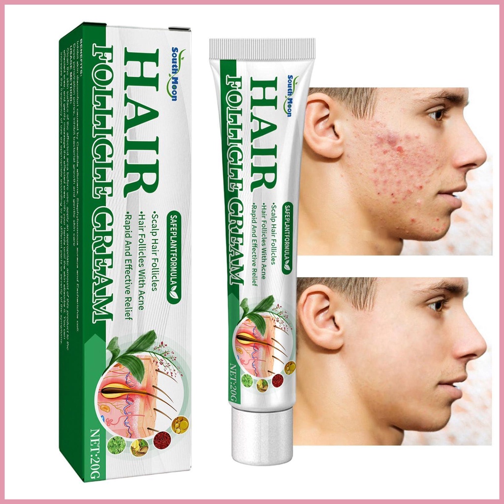 folliculitis-cream-scalp-hair-folliculitis-herbs-treatment-pustules