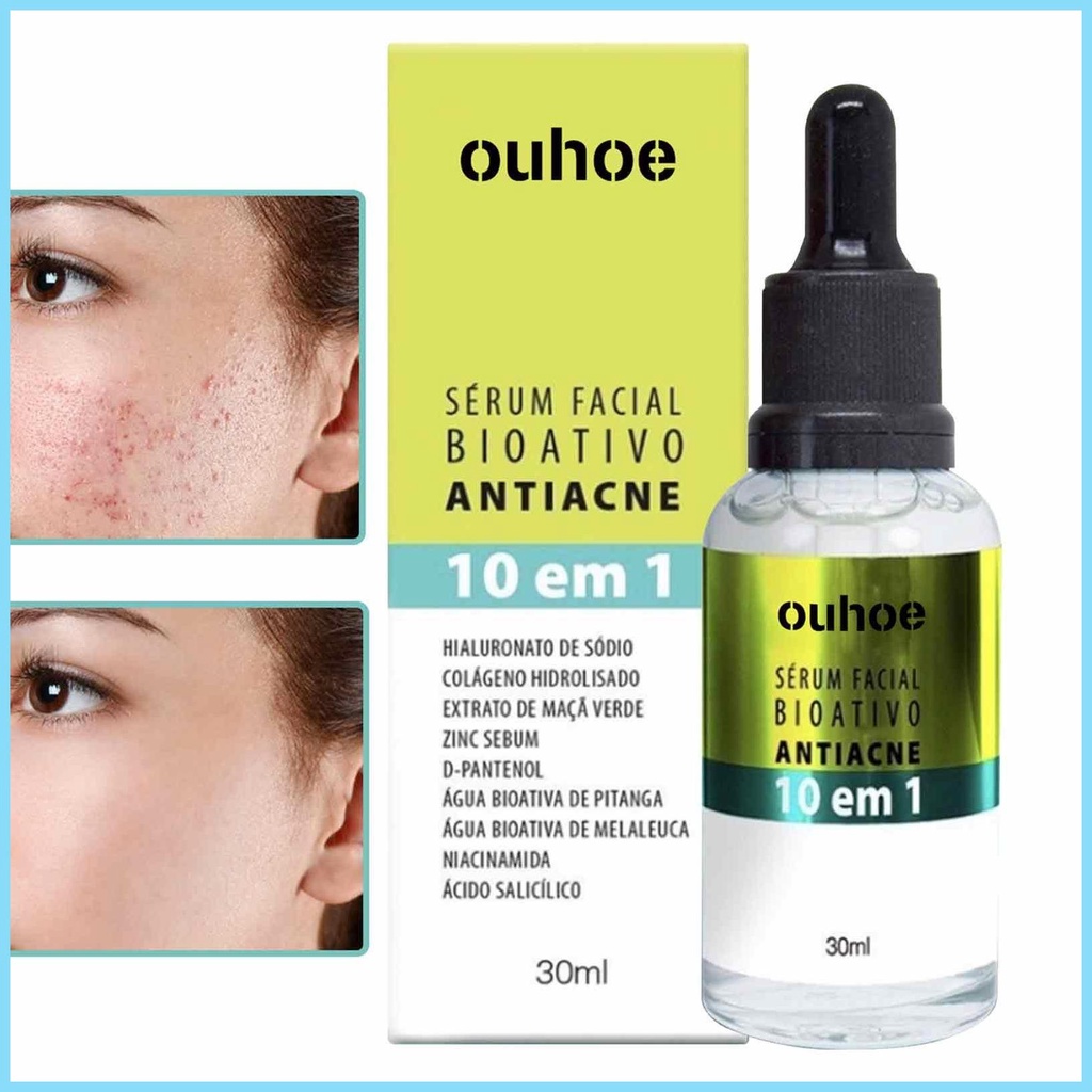 Pimple Liquid Bioactive Face Repair Essence 30ml Pore Minimizer Natural