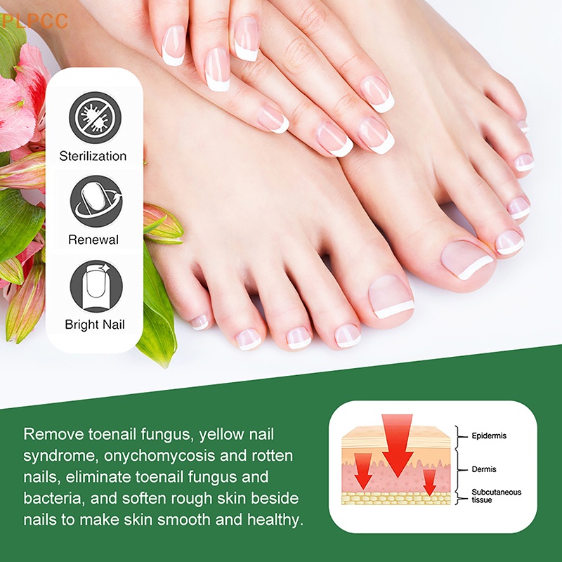 new-nail-fungus-treatment-cream-foot-toe-nail-fungus-removal-serum-anti