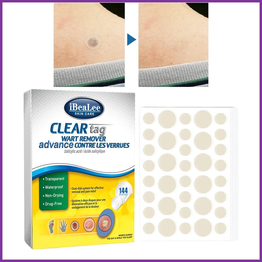 Wart Removal Patches Flat Wart Remover Mole Treat 144pcs/box Filiform ...