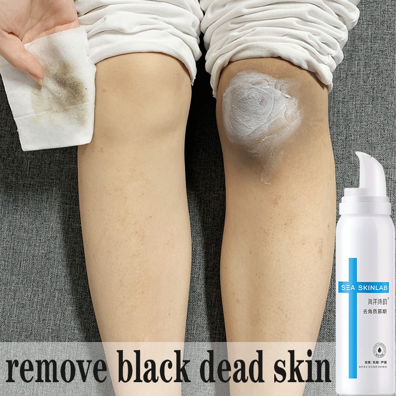 Joint Removal Black Mousse Remove black dead skin Knee Fingers Whole