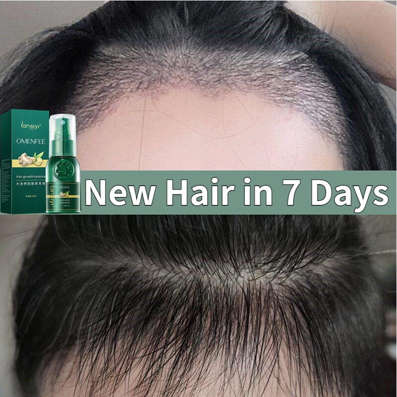 Hair growth serum hair growth lotion hair tonic spray hair loss men anti hair loss treatment