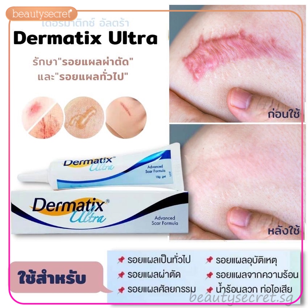 Dermatix Ultra Gel Creams to fade dark scars, keloid scars, scars 15g