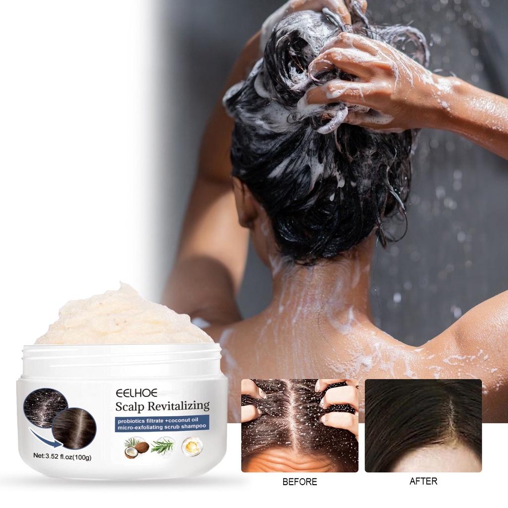 100g Scalp Exfoliator Scrub,Itchy Scalp Treatment for Scalp Dandruff