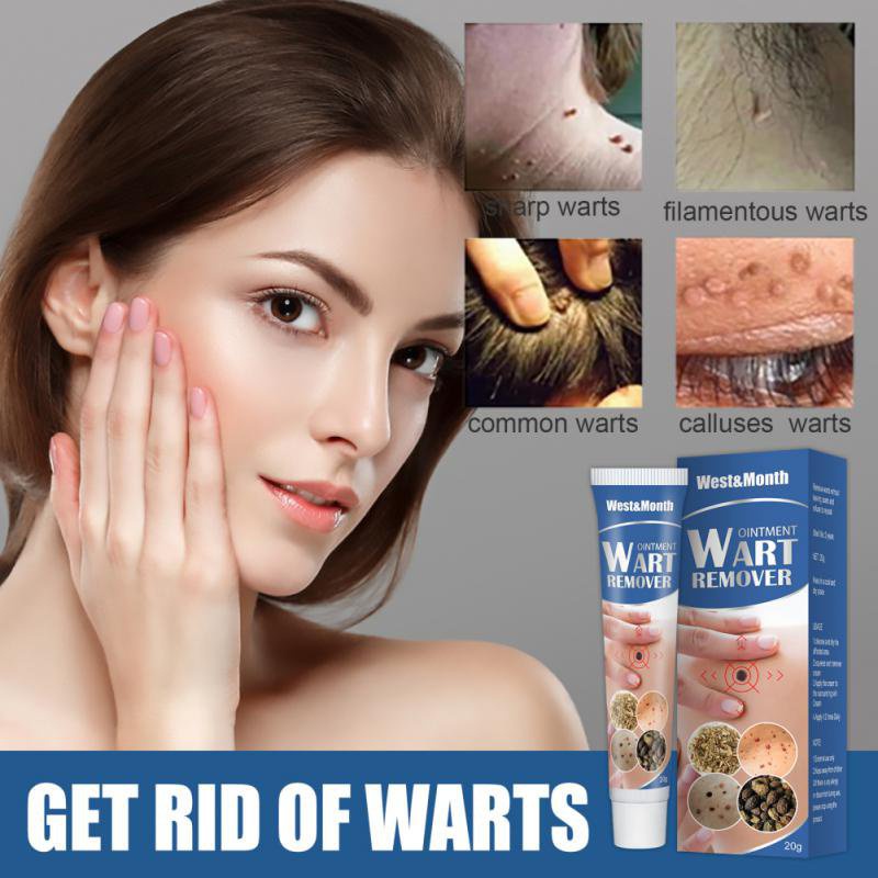 1pcs Wart Removal Ointment Warts & Mole Remover Cream Skin Tag