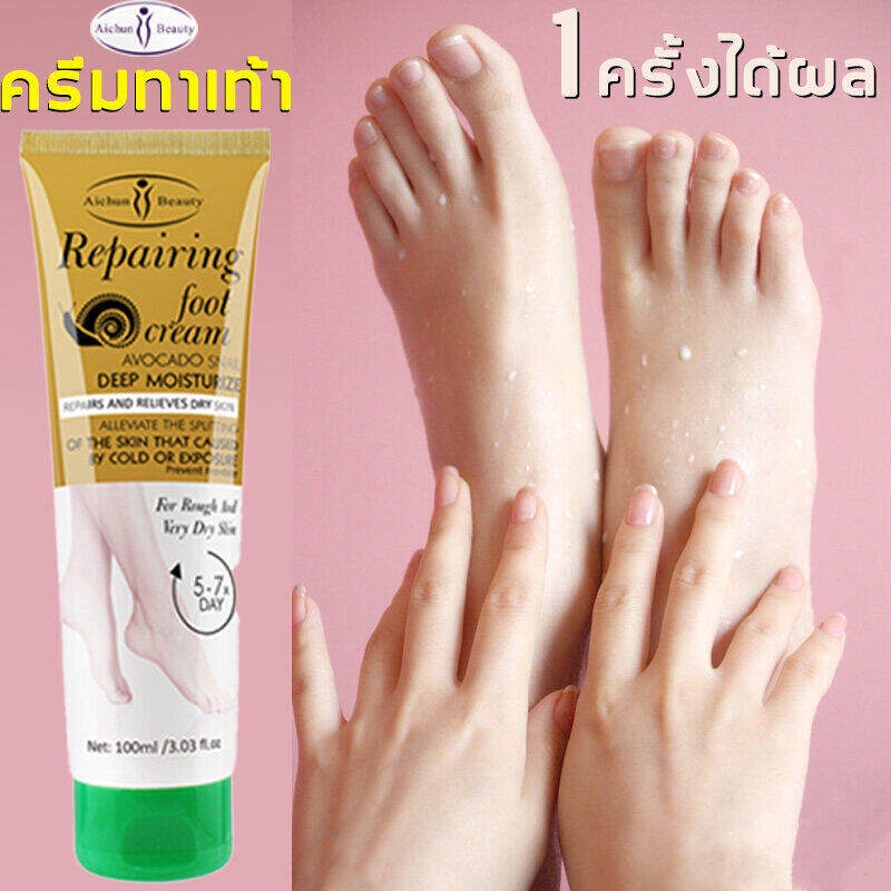 In Stock! Bruises Cramps Gelts Swelling Feet Fungal Infections Cream Get Rid Of Foot Odor/ Itch