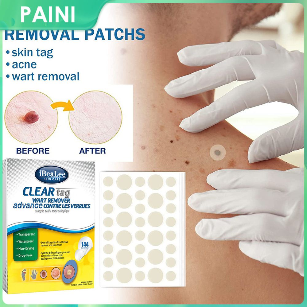 IBeaLee 144pcs Warts Remover Patch Safe Painless Skin Tags Patches ...