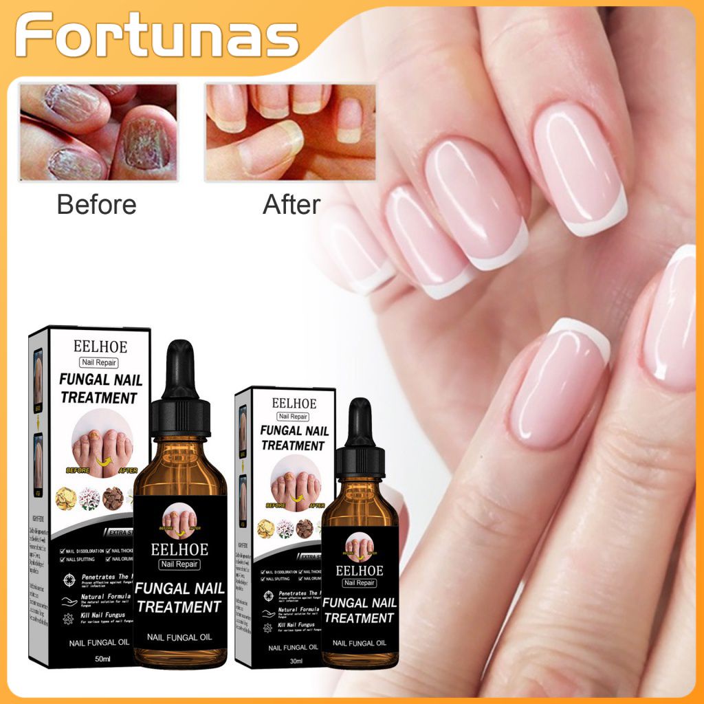 Nail Fungus Treatment Nail Antifungal Nail Repair Stop Fungal Growth