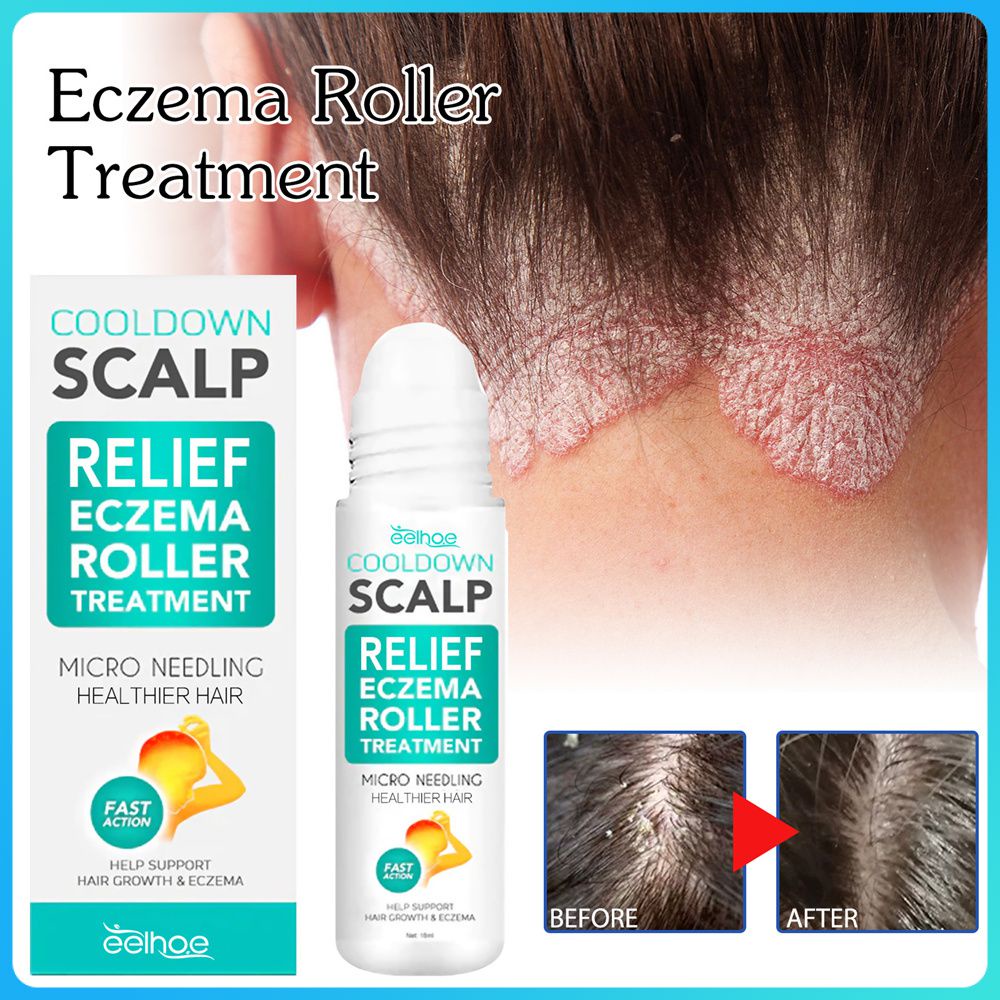 EELHOE Scalp Care Rollerl Psoriasis Cream Menthol Cooling Cream