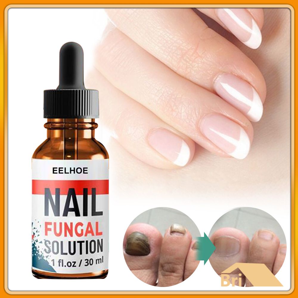 Ready Stock Eelhoe Nail Fungus Repair Liquid Foot Anti Fungal Essence Onychomycosis Repair 7099