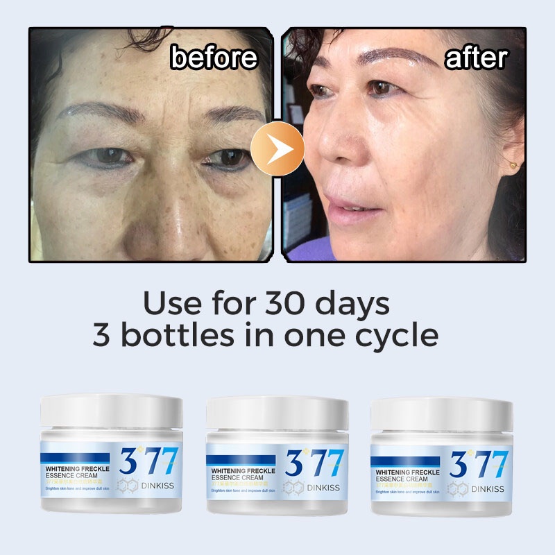 Whitening Cream Remove Dark Spots 377 Whitening Essence Freckles