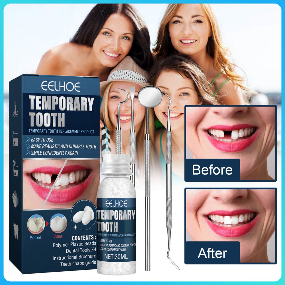 EELHOE Temporary Tooth Repair Kit Filling And Gaps False Solid Glue
