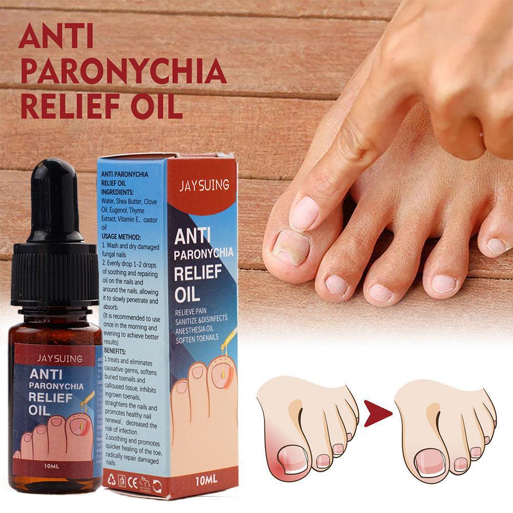 JAYSUING Anti Paronychia Relief Oil Repair Embedded Nail Onychomycosis ...