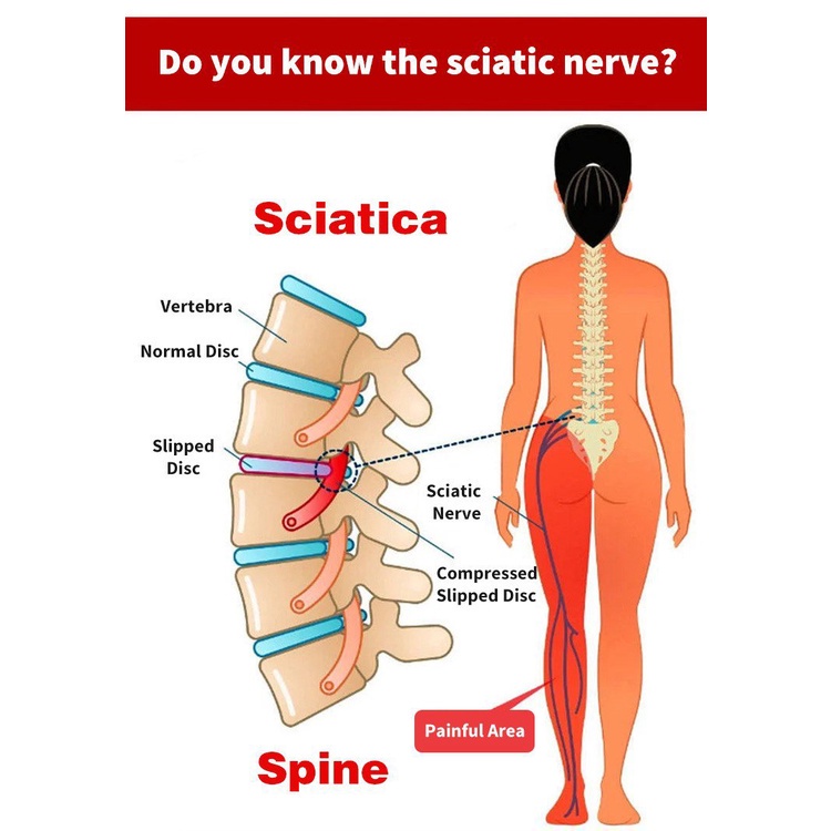 《hot》 (Buy1 get 1 free)Sciatica lumbar protrusion oppresses ointment