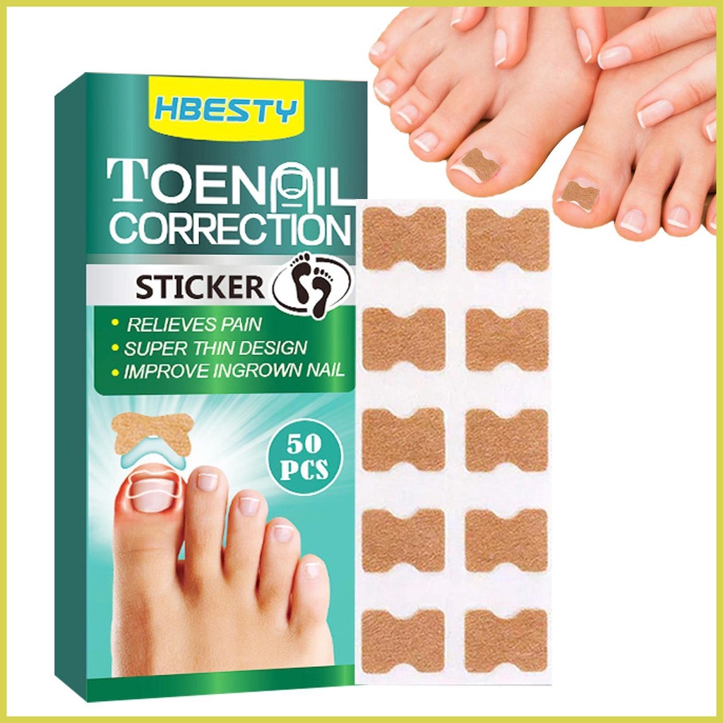 Toenail Corrector Patch Ingrown Toenail Corrector 50pcs Ingrown Toenail
